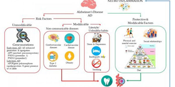Relación entre el consumo de vino, la dieta y la modulación del microbioma oral e intestinal en la enfermedad de Alzheimer