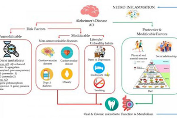 Relación entre el consumo de vino, la dieta y la modulación del microbioma oral e intestinal en la enfermedad de Alzheimer